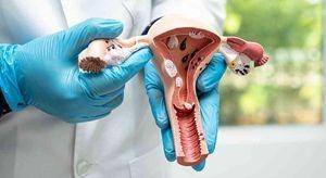 月经血量是常人50倍！女子检查惊现体内藏60粒子宫肌瘤